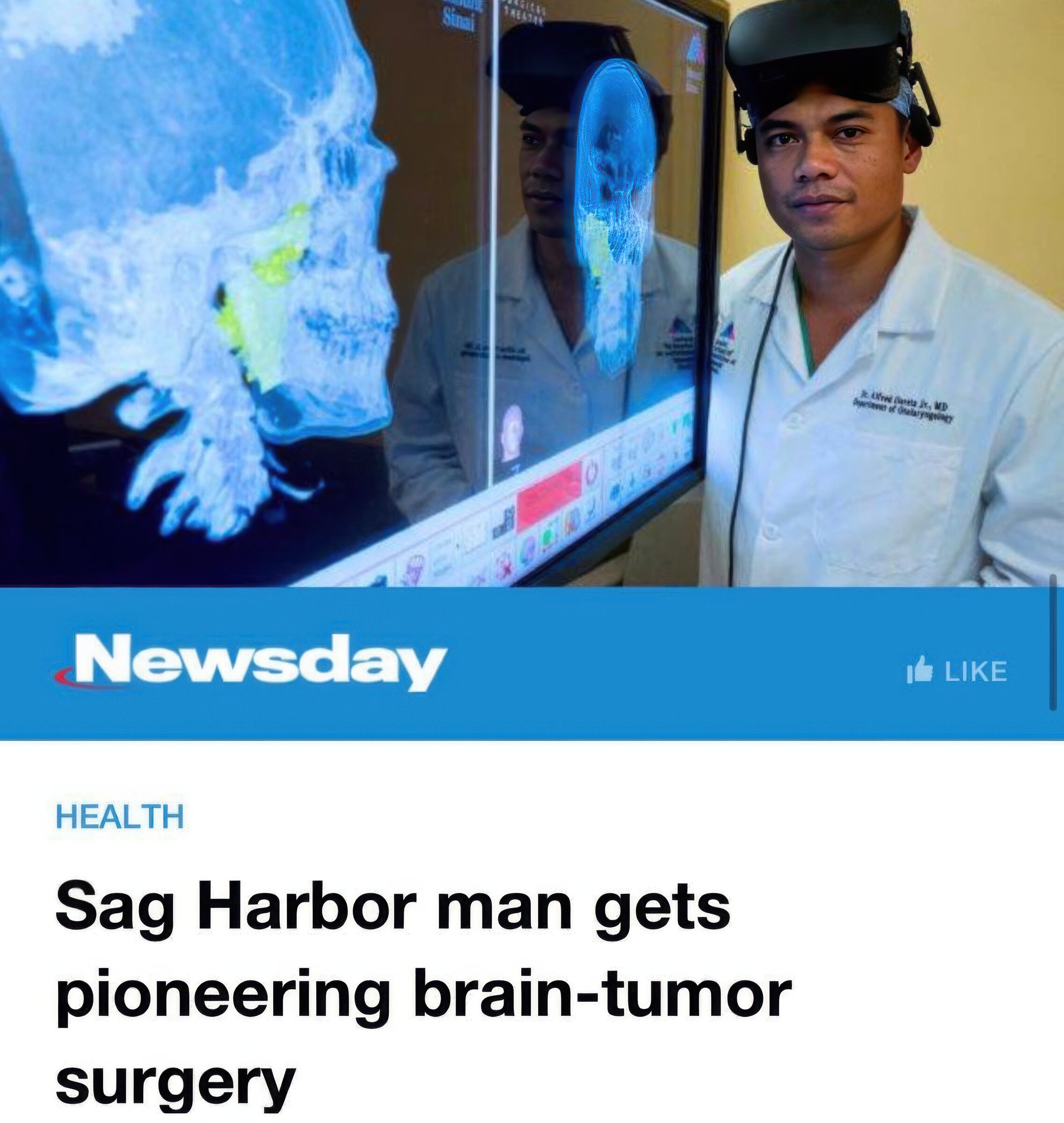 Newsday feature on Dr. Alfred Iloreta using HoloLens augmented reality for skull base surgery at Mount Sinai